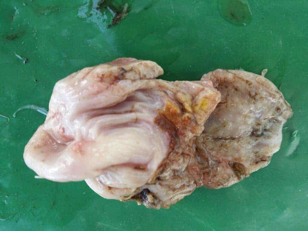 Quemaduras por formaldehido