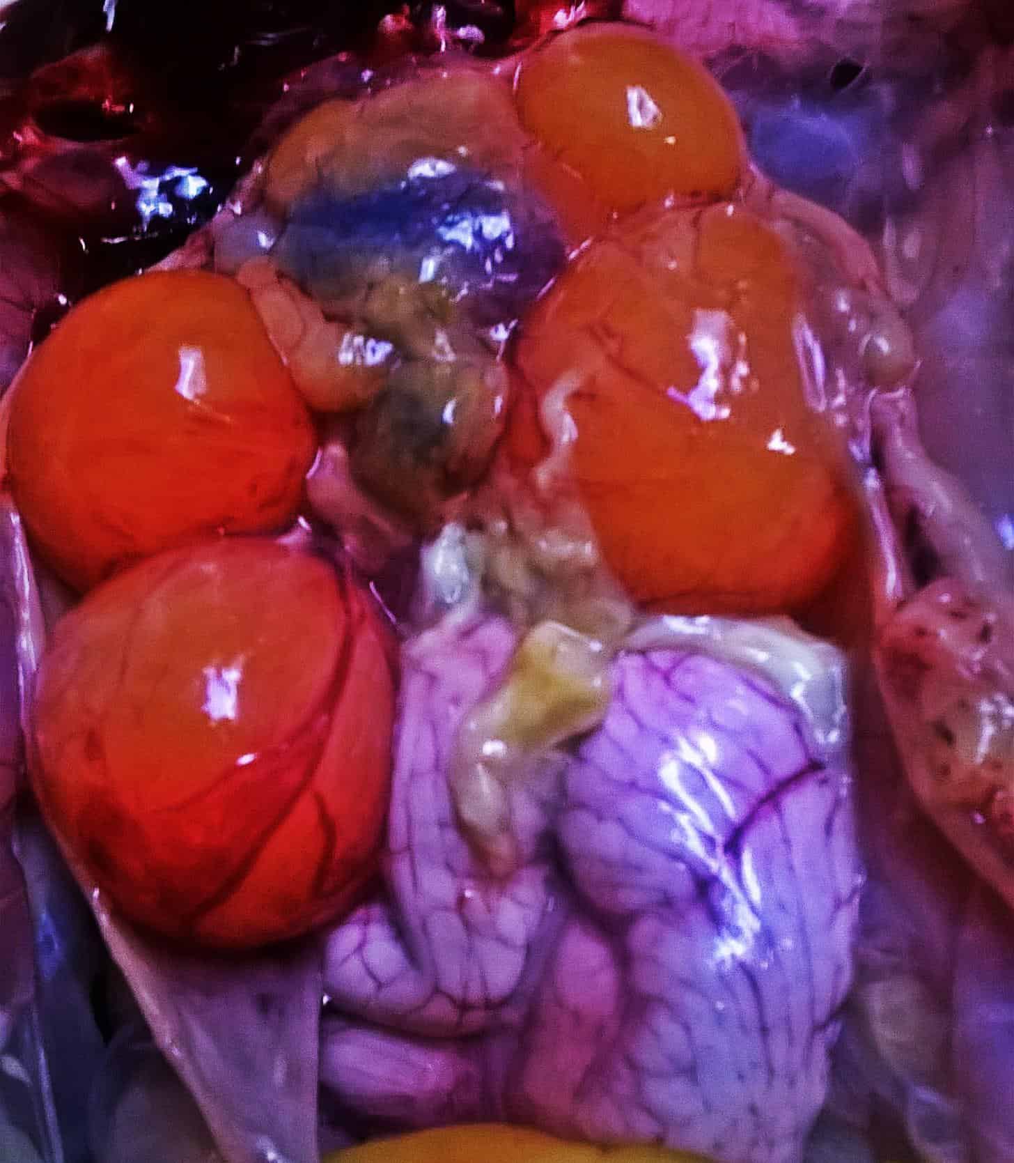 Infección ovárica