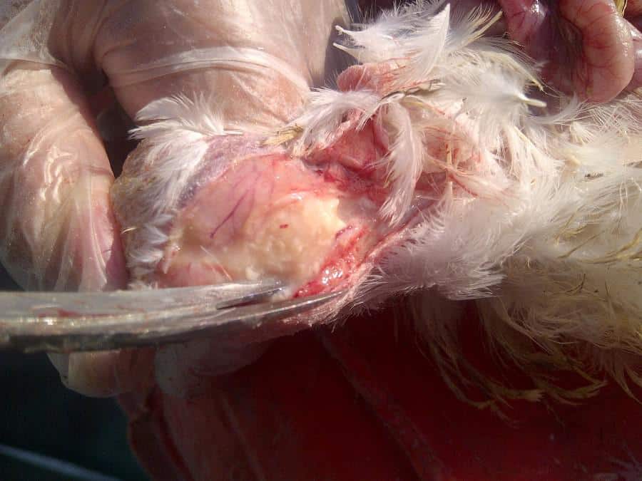 Caseum in the gastrocnemius