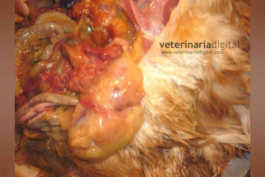 Postura Intraabdominal