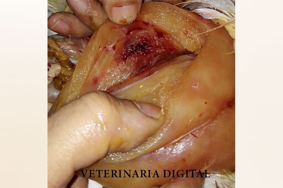 Deep pectoral necrosis