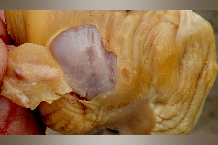 Mycosis in the gizzard