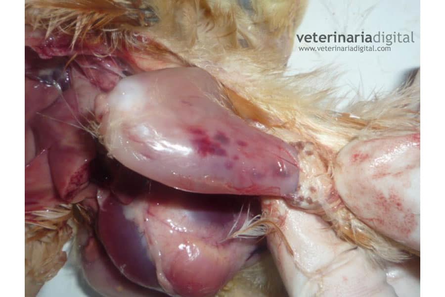 Bleeding in Large Muscle