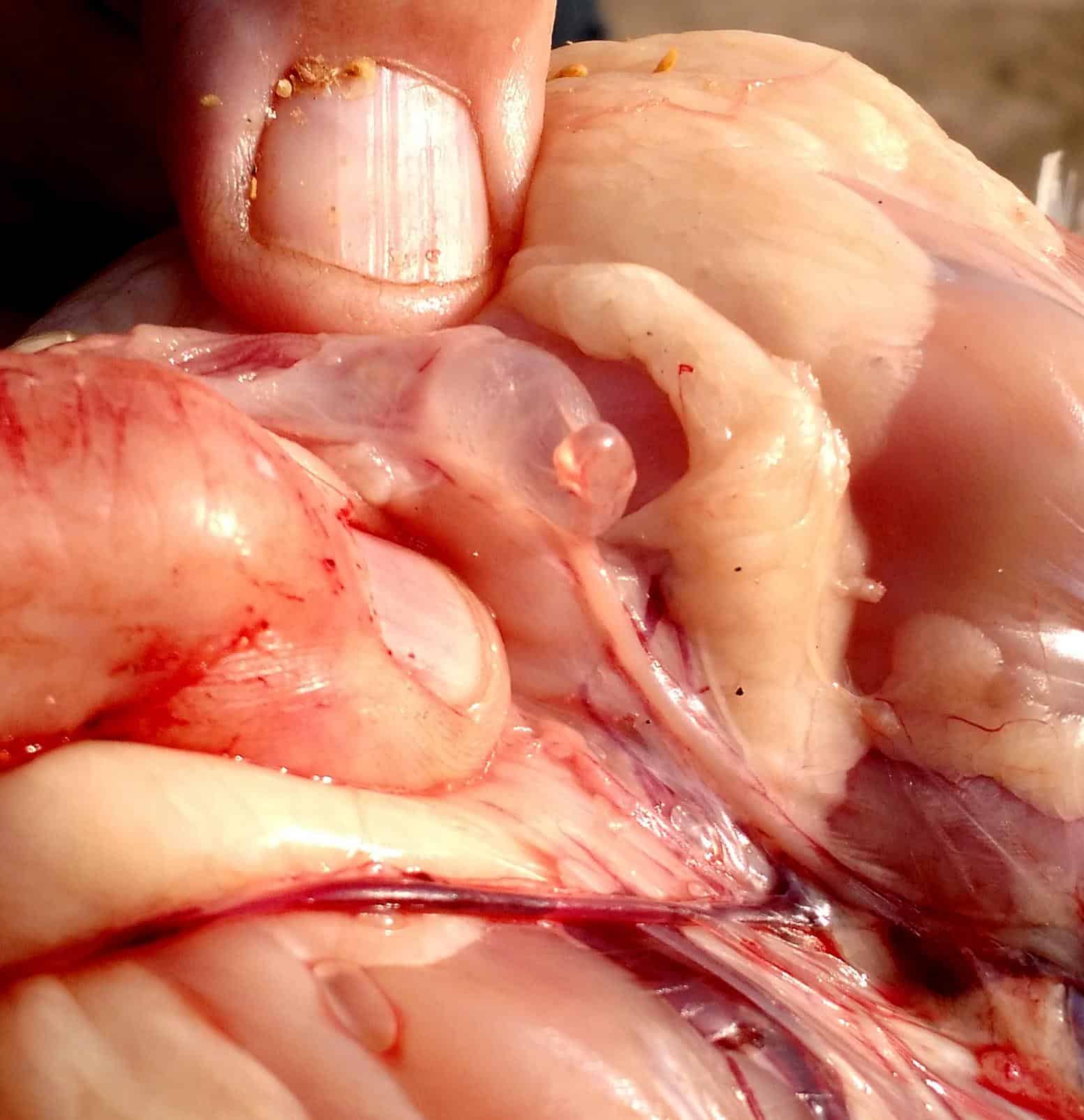 Bronquitis infecciosa: Hidrosalpingitis de oviducto derecho