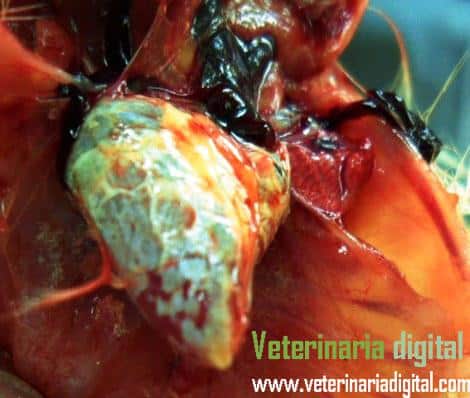 Onfalitis y pericarditis en la hepatoenteritis tóxica infecciosa