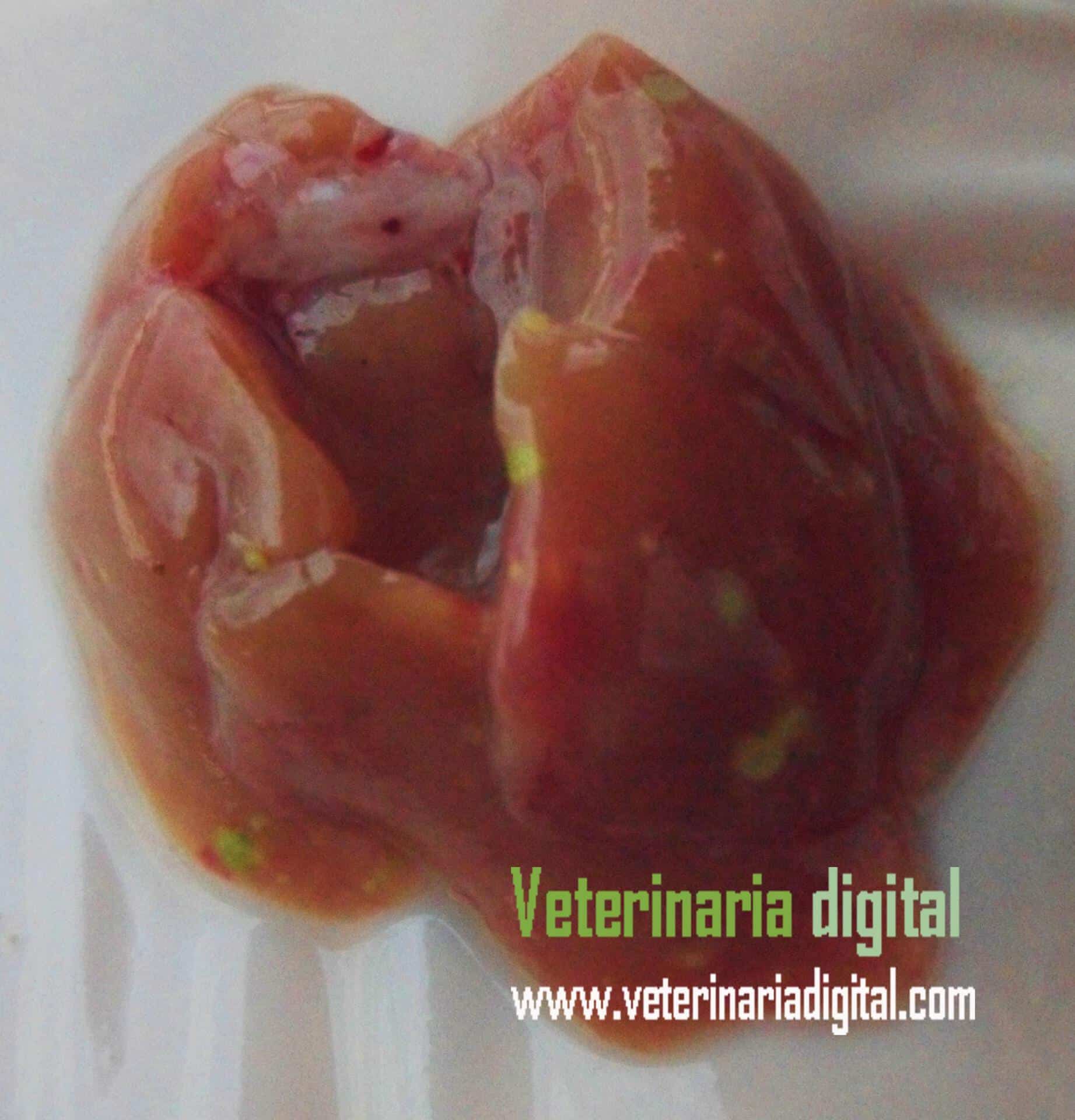 Infectious toxic hepatoenteritis