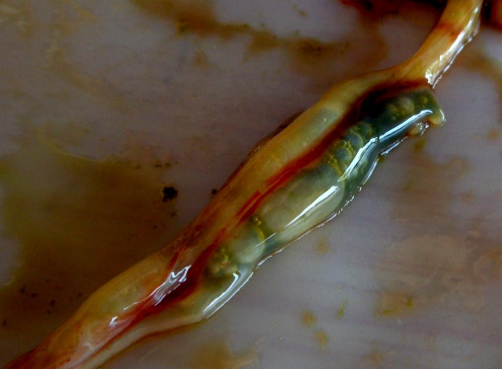 Tiflitis por hepatorenteritis toxica infecciosa aviar