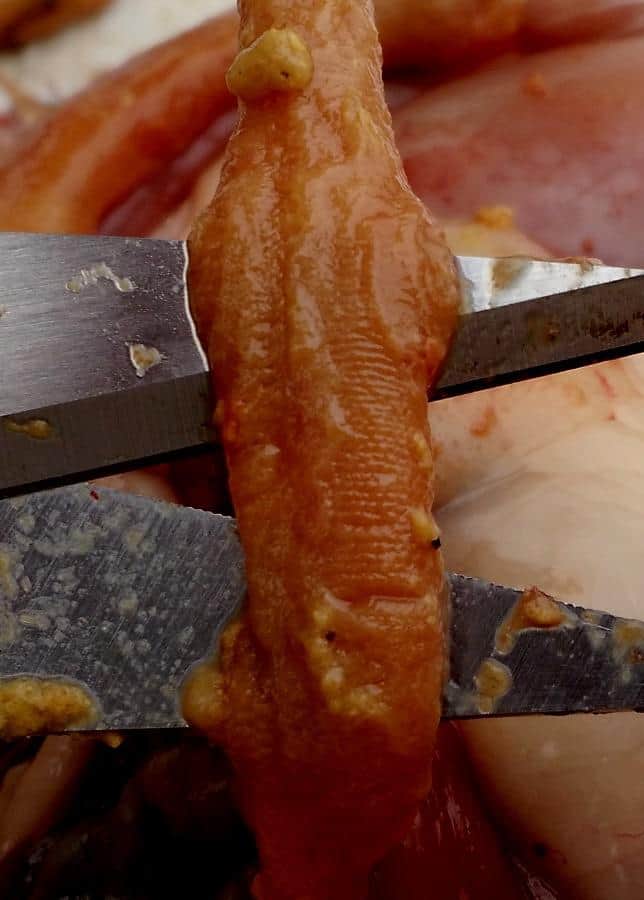 Deficiencia de biotina