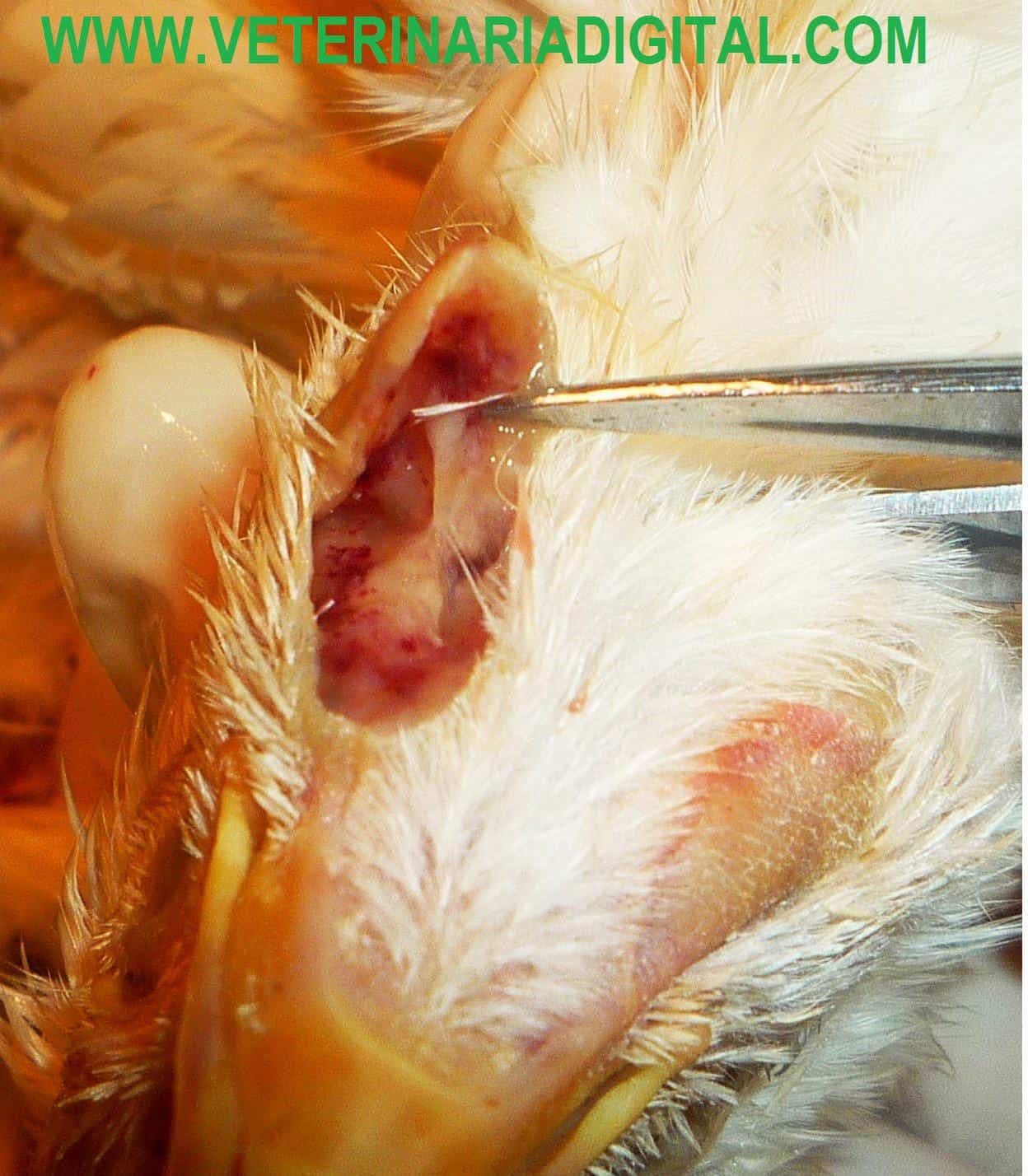 Sinusitis