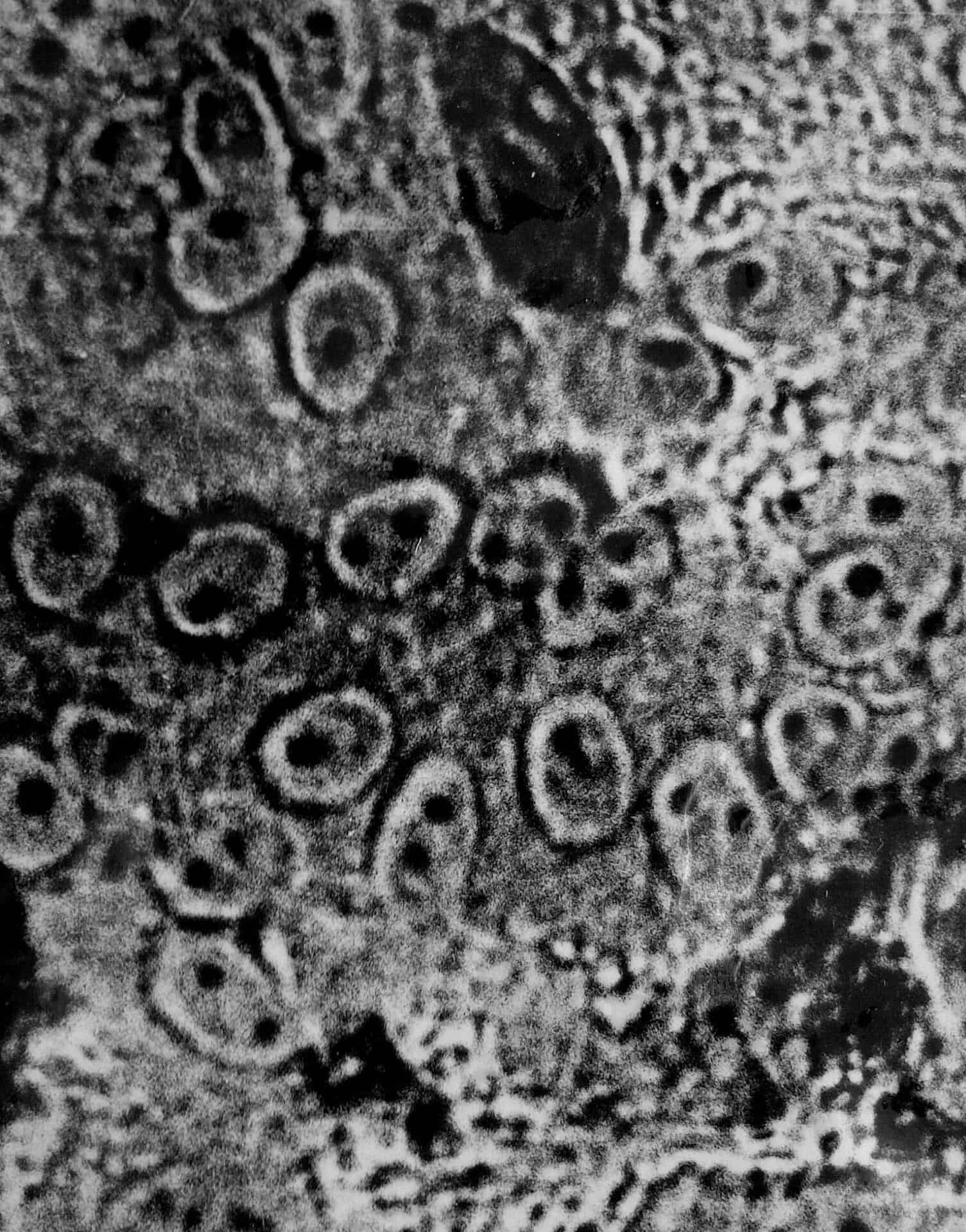 Multinuclear cysts due to Entamoeba meleagridis