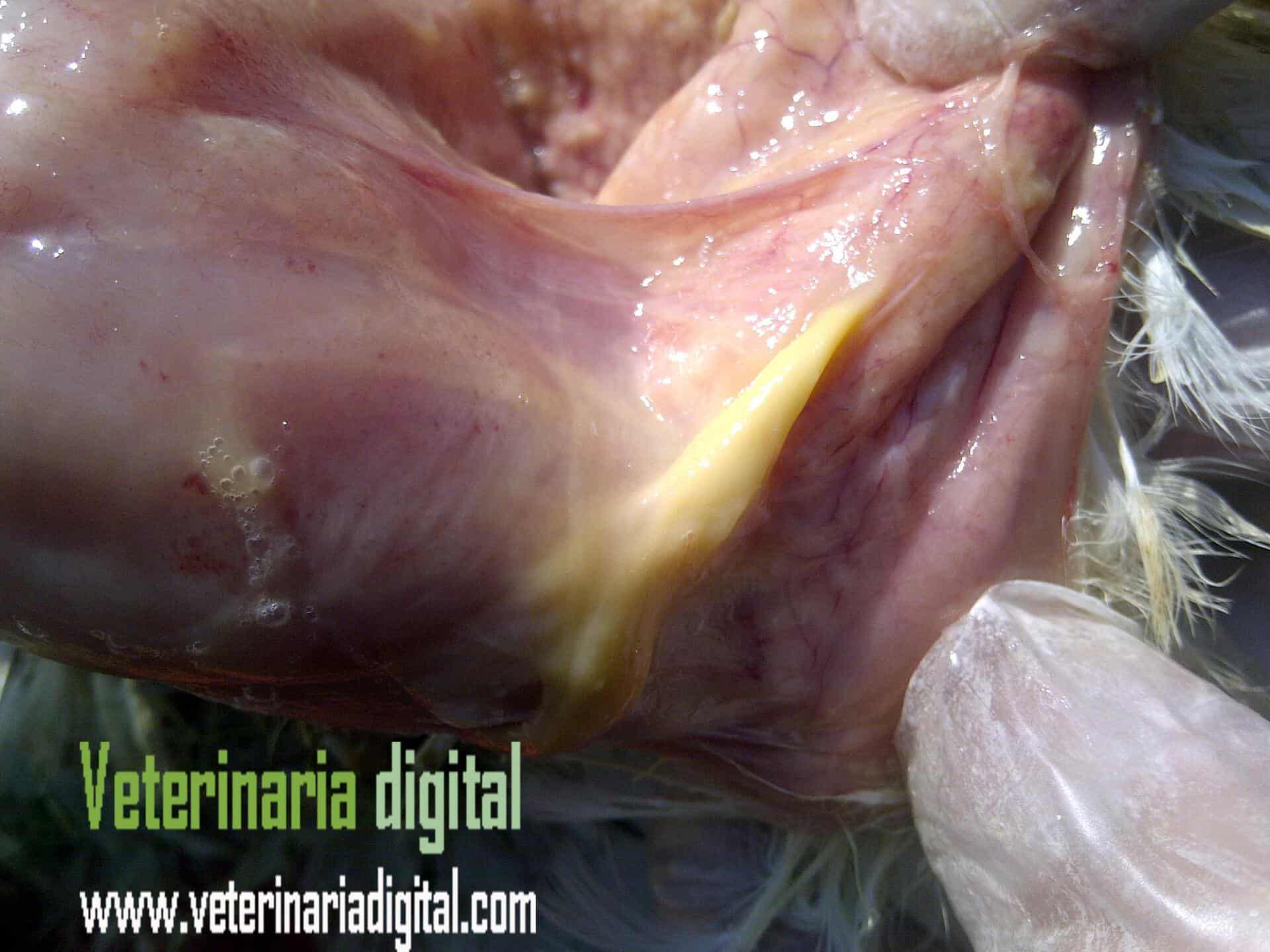 Absceso subcutáneo en síndrome sinusitis-traqueítis-tendinitis