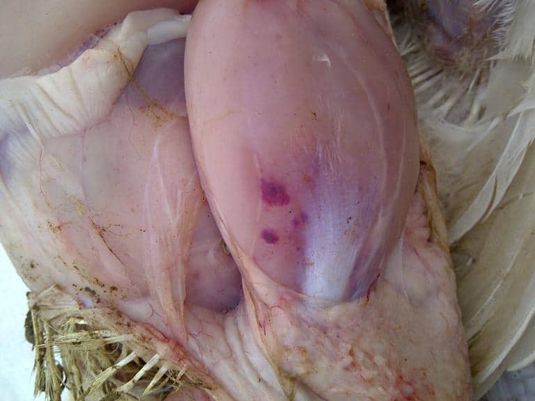 Aflatoxicosis