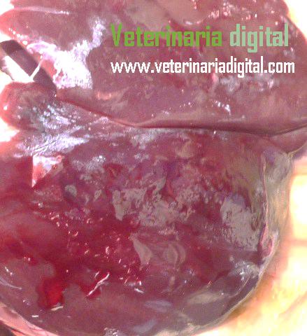 Gota visceral hepática