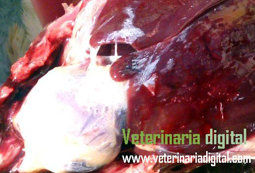 Gota visceral cardiaca