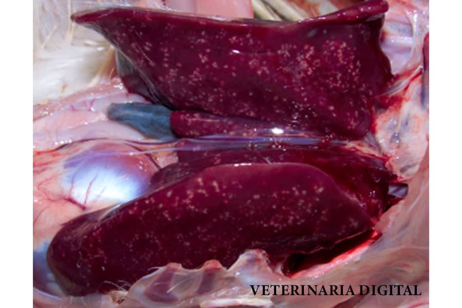 Hepatitis by Shigella