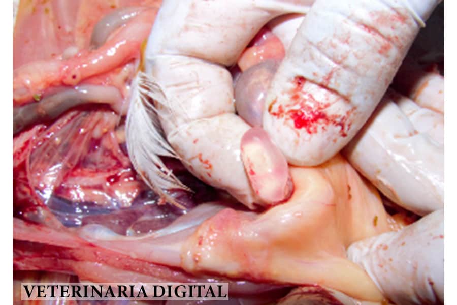 Hidrosalpingitis temprana