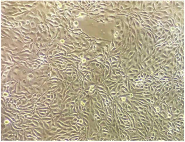 Efecto de un microbiocida intestinal (anillo cimenol) sobre Clostridium perfringens en cultivos de enterocitos