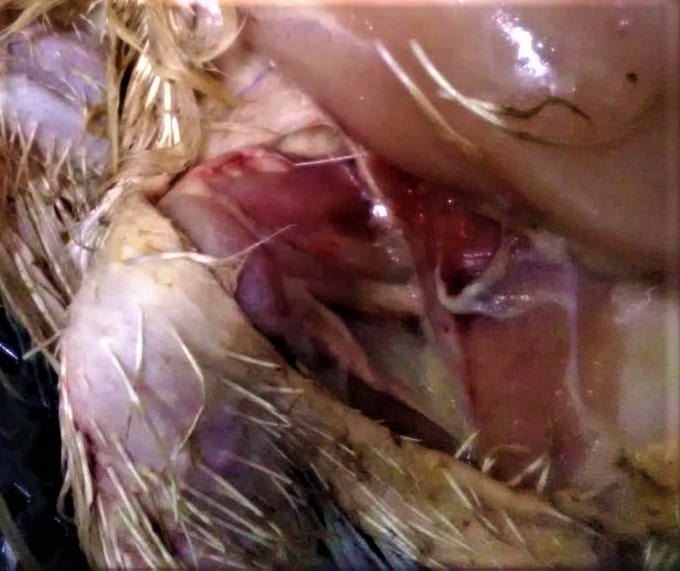 Hemorrhages in the adductor muscles