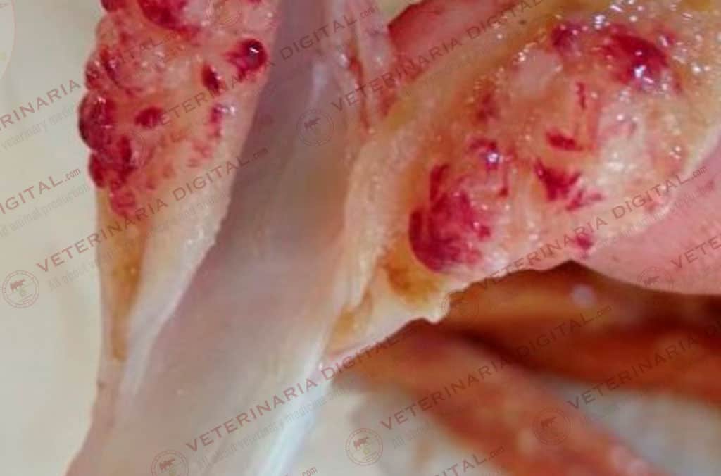 Mucormycosis in the ileocecal valves