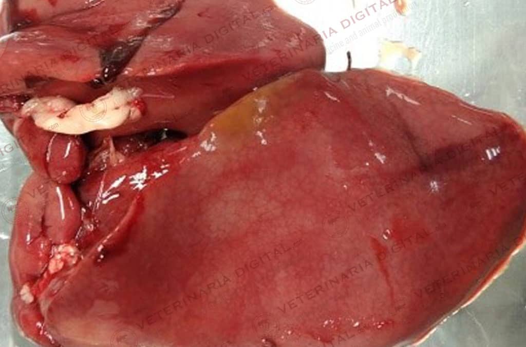 Hepatitis por Campylobacter