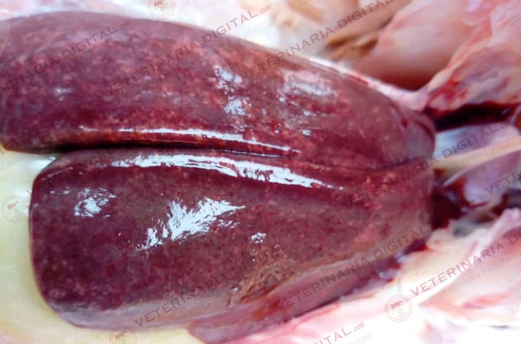 Hepatitis by Shigella